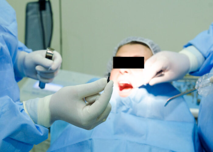 implant procedure